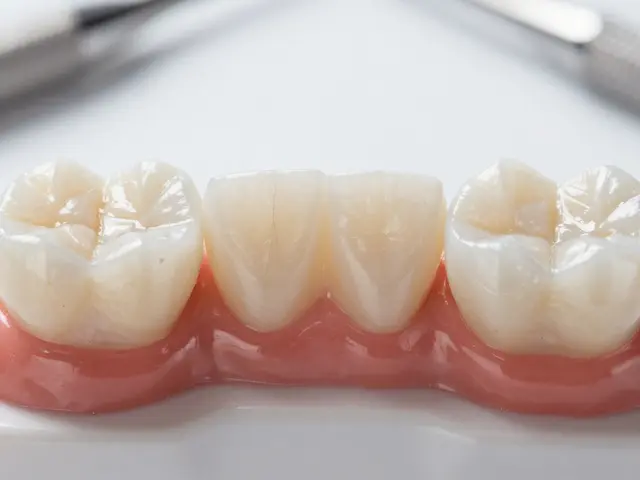 Porovnání materiálů pro zubní fazety: keramika, kompozit a zirkonie - co je lepší?