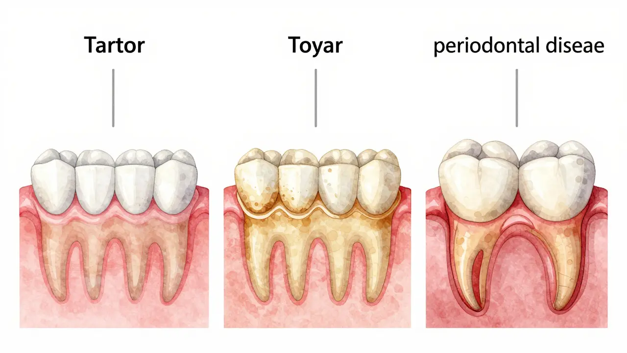 Postupné zhoršení zubního kamene u psa: plak → kámen → poškození dásní.