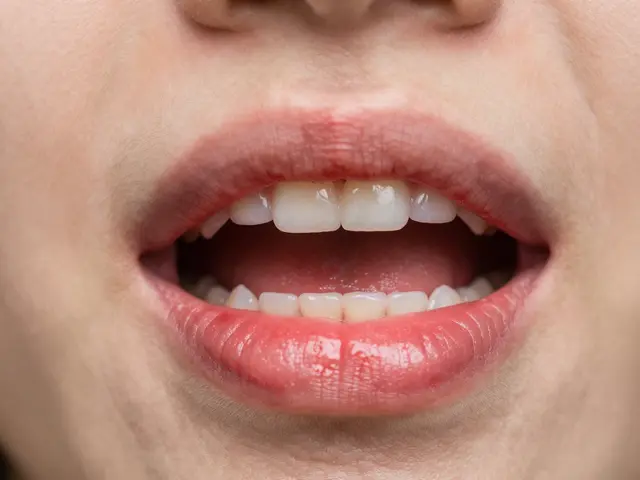 Co je nejlepší na dásně pro zdravé dásně a odstranění zubního kamene pod dásní?