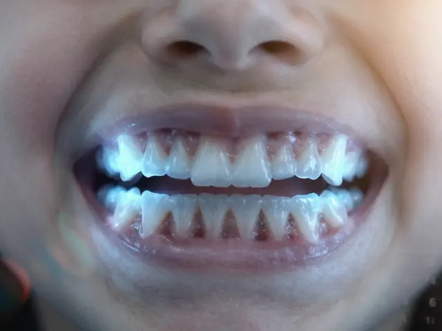 Tetracyklinové zuby: Proč je důležité je řešit včas