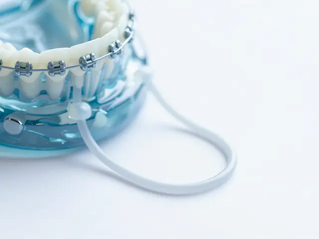 Jak se vyhnout problémům s gumičkami na rovnátka: Praktický průvodce