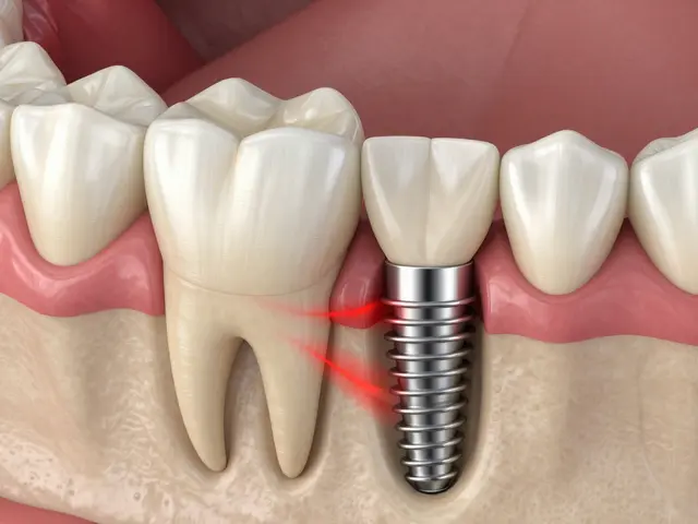 Jak zubní implantáty zlepšují život po léčbě bruxismu: Kompletní průvodce